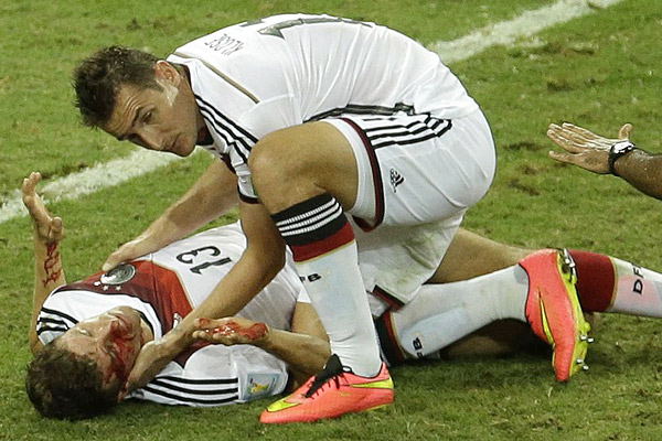  "مولر" پس از این برخورد، دچار پارگی ابرو شد