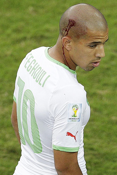  "صوفیان فغولی" بازیکن الجزایر در بازی با روسیه دچار شکستگی از ناحیه سر شد