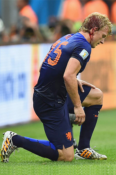  شکستن سر "درک کویت" در بازی با برزیل