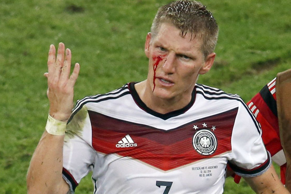  "شواین اشتایگر" در بازی فینال دچار مصدومیت از ناحیه صورت شد