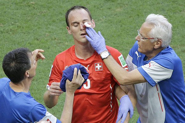  "استیون وون برگن" بازیکن سوئیس بعد از خطای "اولیویه ژیرو" دچار شکستگی صورت می‌شود