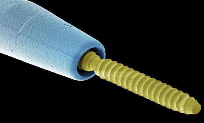 تصویر میکروسکوپی از پین های ایمپلنت دندانپزشکی 