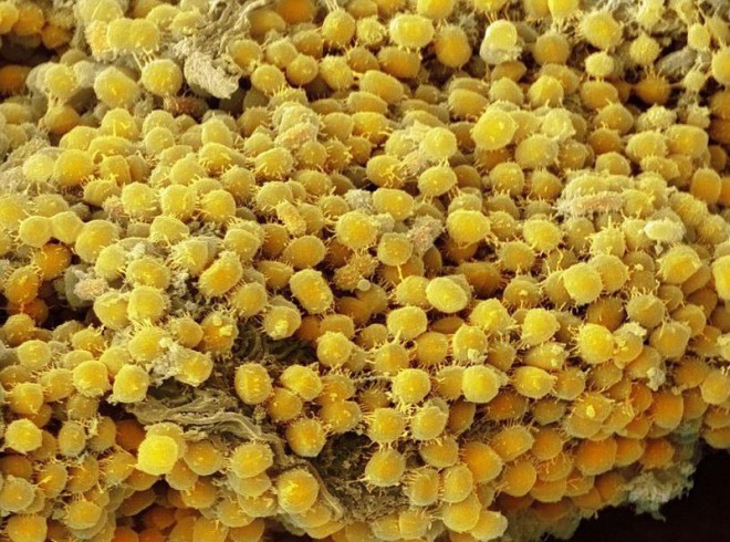 باکتری‌های زرد رنگ موجود در لثه 