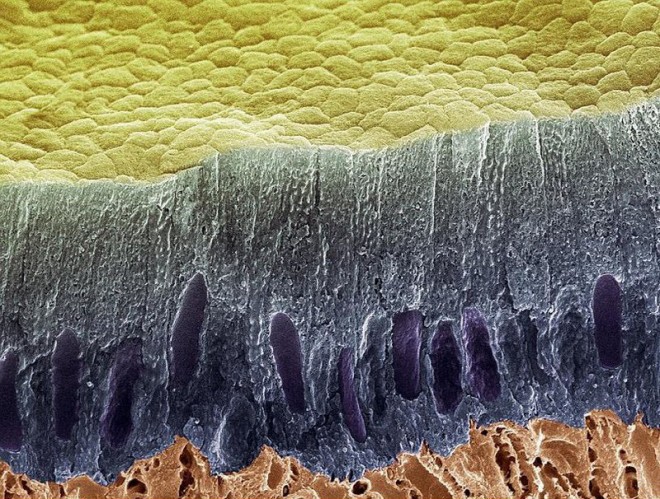 لایه سلولی تشکیل‌دهنده مینای دندان به رنگ آبی