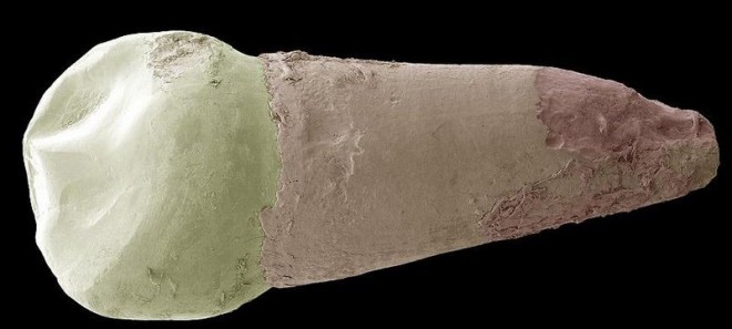 عکس میکروسکوپی دندان نیش شیری یک کودک