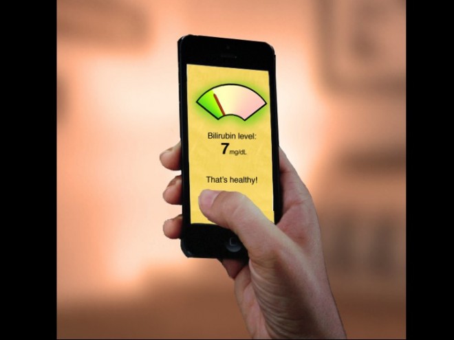 با تلفن همراه«زردی نوزاد» خود را تشخیص دهید + عکس 2 Interface