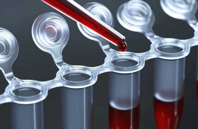 بيماري غلظت خون و راه هايي براي درمان آن؟ 4 20624