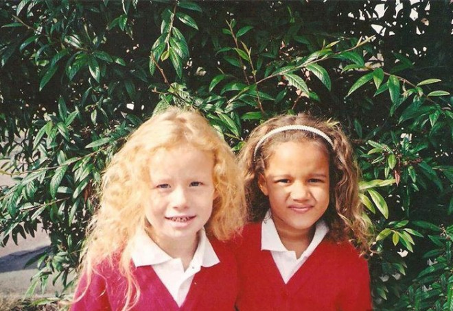 خواهران دو قلو سفید و سیاه پوست + عکس 4 black-white-skin-twin-sisters-lucy-maria-aylmer-21