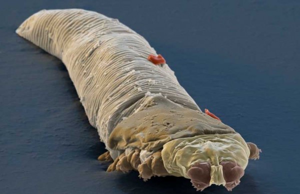 Demodex folliculorum