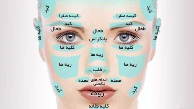 بیماری هایی که از روی چهره انسان قابل تشخیص هستند ؟ 2 بیماری هایی که از روی چهره انسان قابل تشخیص است
