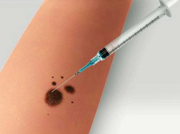 معرفی ۱۲ اختراع مهم پزشکی که این علم را متحول کرد 10 معرفی 12 اختراع مهم پزشکی که این علم را متحول کرد