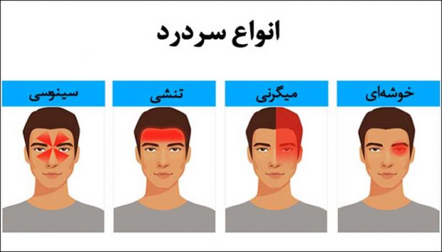 انواع سردرد