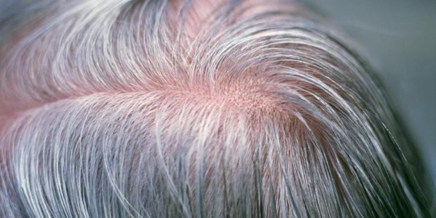 دلایل سفید شدن زود هنگام موی سر در تحقیقات جدید دانشمندان مشخص شد ؟ 2 دلایل سفید شدن زود هنگام موی سر