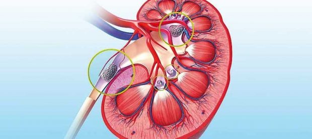 فواید نوشیدن آب بعد از بیدار شدن از خواب را نادیده نگیرید ؟ 11 فواید نوشیدن آب