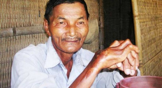 عجیب ترین انسان های جهان