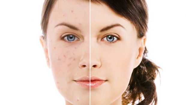 روغن آرگان چه مزایایی دارد؟ 6 روغن آرگان