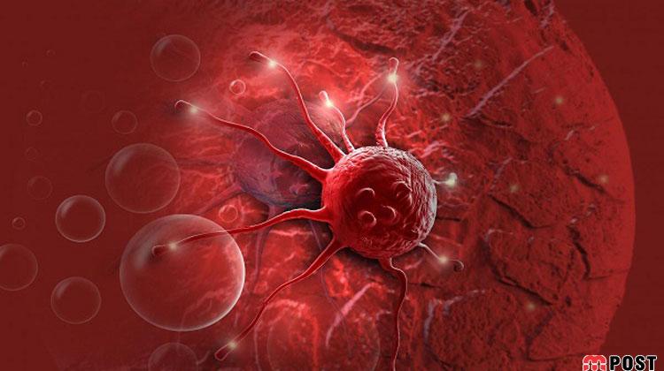 آیا ادویه هل سلولهای سرطان پستان تهاجمی سهگانه منفی را از بین می برد ؟ 11 سرطان پستان