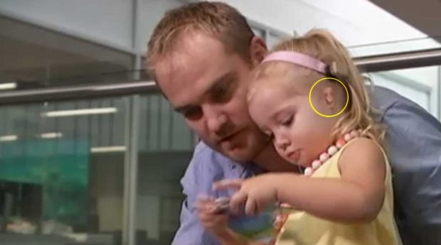 تولید پروتز لاله گوش با فناوری چاپ سه بعدی