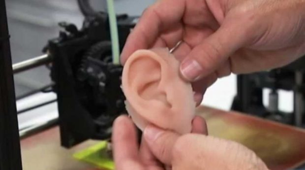 تولید پروتز لاله گوش با فناوری چاپ سه بعدی