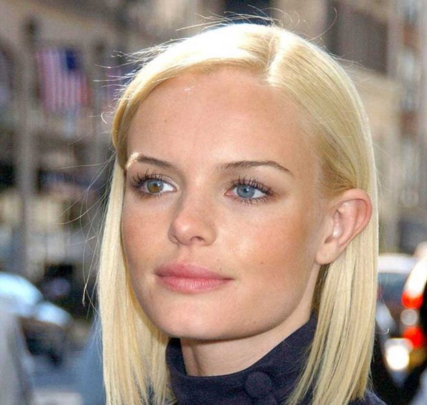 چرا رنگ عنبیه چشم بعضی از افراد و حیوانات متفاوت است ؟ 2 رنگ عنبیه چشم