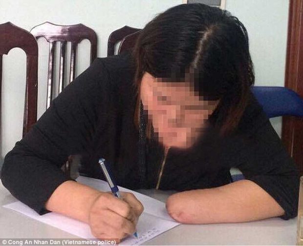 زنی ویتنامی دست و پایش را برای دریافت دیه قطع کرد ؟!