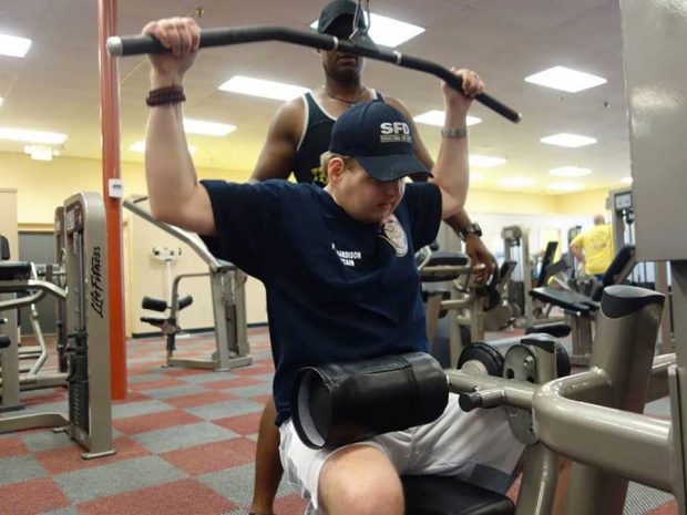 پیوند صورت هاردیسون آتش نشان بعد از یکسال