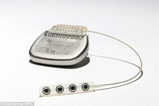 درمان بیماران نخاعی در آینده امکان پذیر خواهد شد + عکس 6 درمان بیماران نخاعی در آینده امکان پذیر خواهد شد ؟