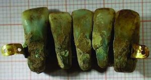 دندان مصنوعی ۴۰۰ ساله