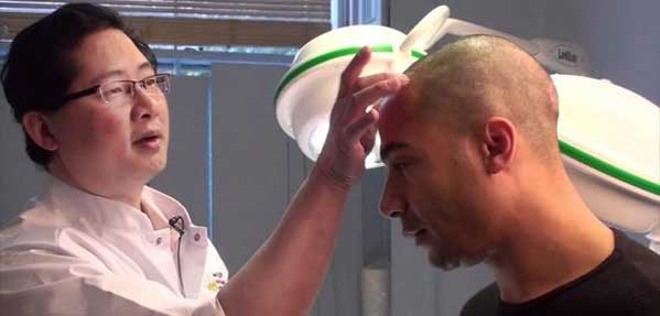 رویش مجدد مو