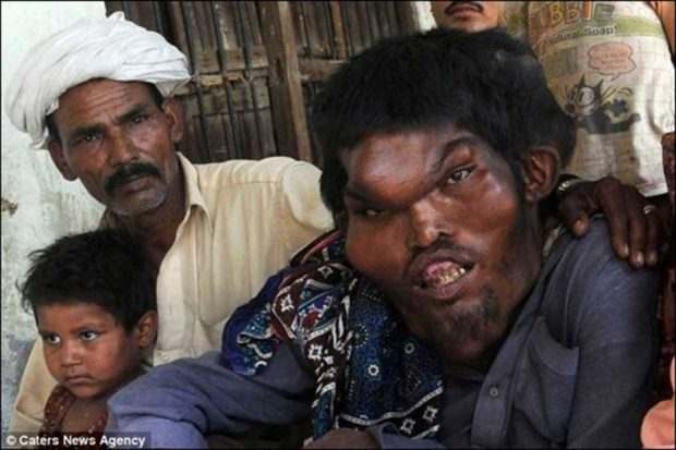 انسان های عجیب