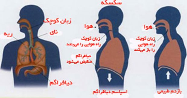 سکسه مداوم نشان دهنده ی 8 بیماری خطرناک است ؟ 2 سکسه مداوم