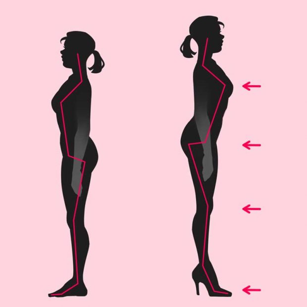 ضررهای کفش پاشنه بلند