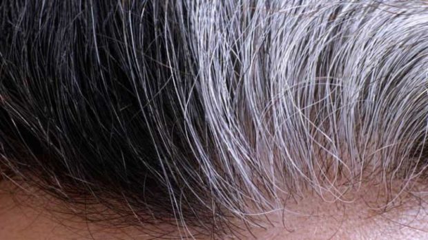 سفید شدن مو با استرس همراه است 2 سفید شدن مو با استرس