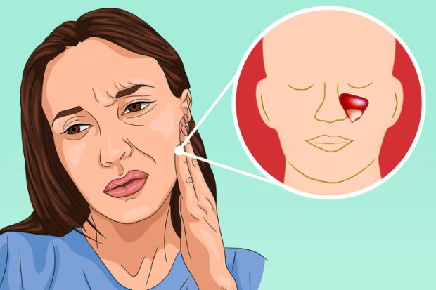 کدام دردهای ناحیه فک به دندان ها ارتباطی ندارد ؟ 5 دردهای ناحیه فک