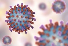 ویروس سین‌ سیشیال تنفسی Respiratory Syncytial Virus