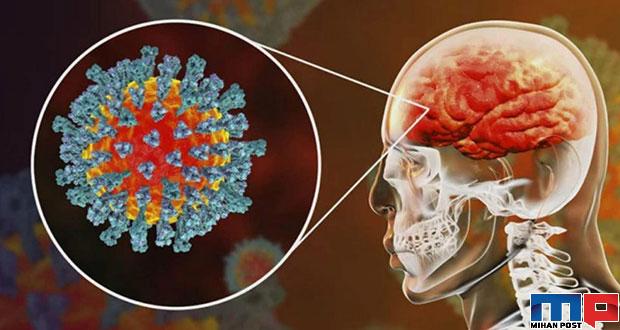 اثرات کرونا روی مغز حالا بیشتر برای دانشمندان مشخص شده 1 اثرات کرونا روی مغز