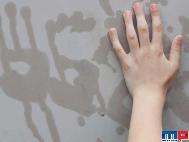 عرق کردن کف دست چه دلایلی دارد ؟ 3 عرق کردن کف دست