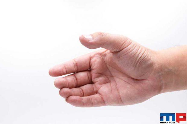 عرق کردن کف دست چه دلایلی دارد ؟ 2 عرق کردن کف دست