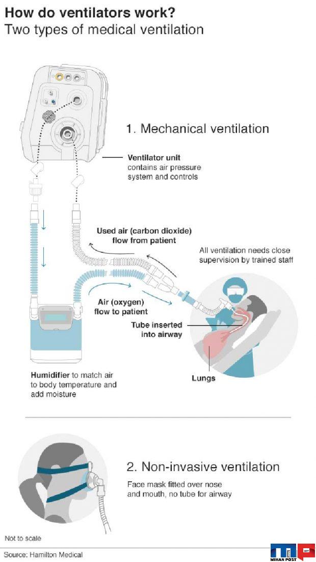 ونتیلاتور چیست ؟ آشنایی با دستگاهی که باعث نجات بیماران کرونایی است 2 ونتیلاتور چیست