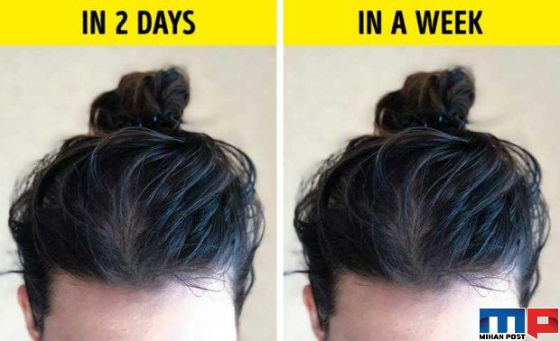 جلوگیری از چرب شدن موی سر