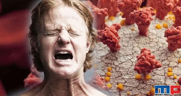 درد ماهیچه ساق پا از نشانه های جدید کرونا است ! 12 درد ماهیچه ساق پا