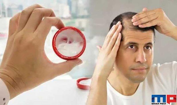 درمان ریزش مو با سیر چگونه امکان پذیر خواهد شد! 2 درمان ریزش مو با سیر