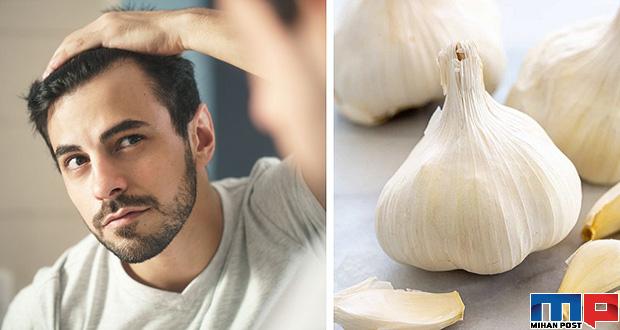 درمان ریزش مو با سیر چگونه امکان پذیر خواهد شد! 12 درمان ریزش مو با سیر