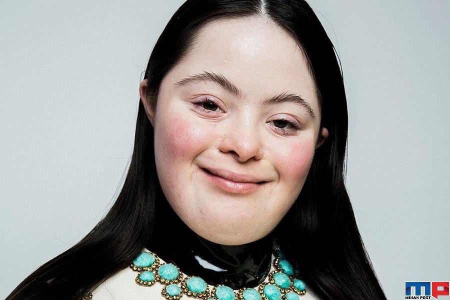 نگاهی به زندگی الی گلداشتاین مدل سندروم داونی برند گوچی 7 الی گلداشتاین