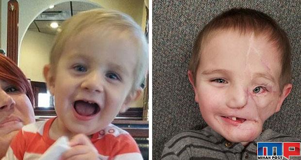 رایدر ولز Ryder Wells کودکی که بخاطر خواهرش قربانی حمله سگ شد 14 رایدر ولز Ryder Wells