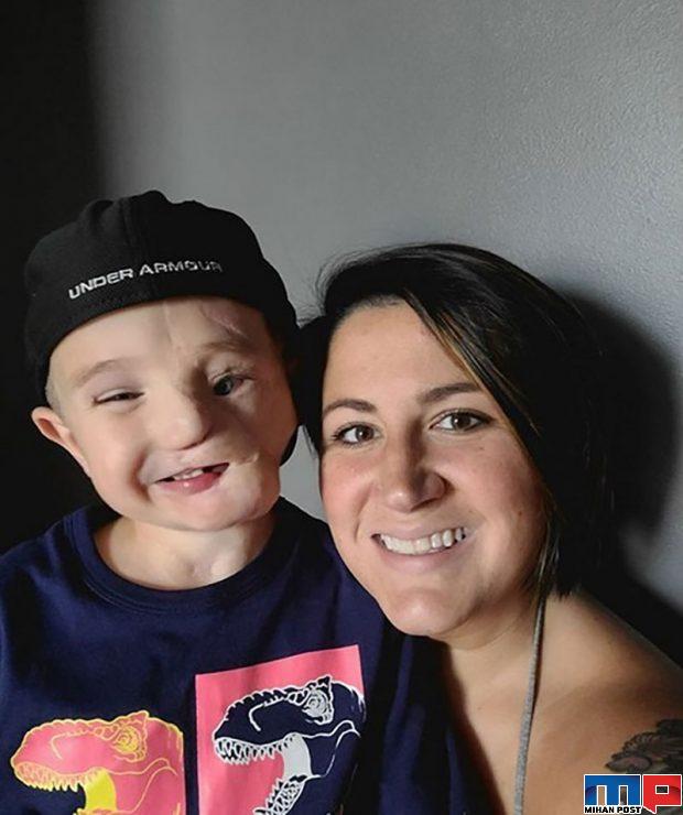 رایدر ولز Ryder Wells کودکی که بخاطر خواهرش قربانی حمله سگ شد 8 رایدر ولز Ryder Wells