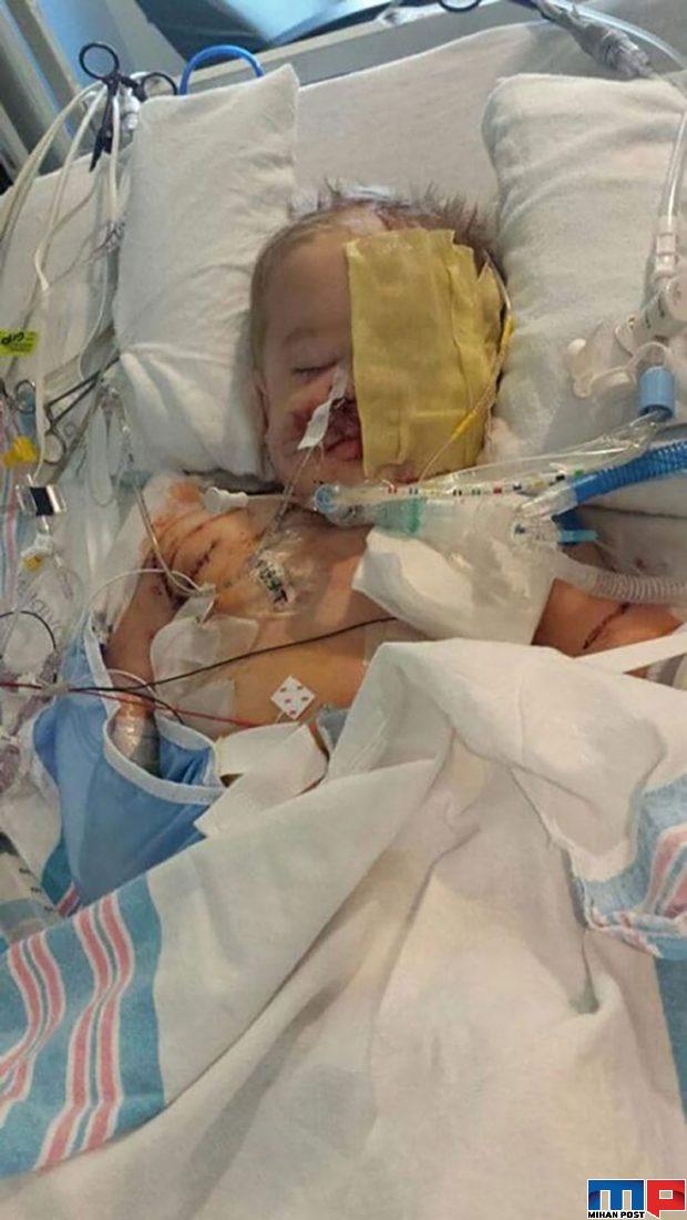 رایدر ولز Ryder Wells کودکی که بخاطر خواهرش قربانی حمله سگ شد 5 رایدر ولز Ryder Wells