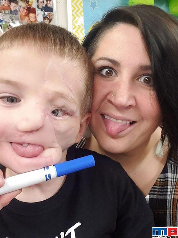 رایدر ولز Ryder Wells کودکی که بخاطر خواهرش قربانی حمله سگ شد 2 رایدر ولز Ryder Wells