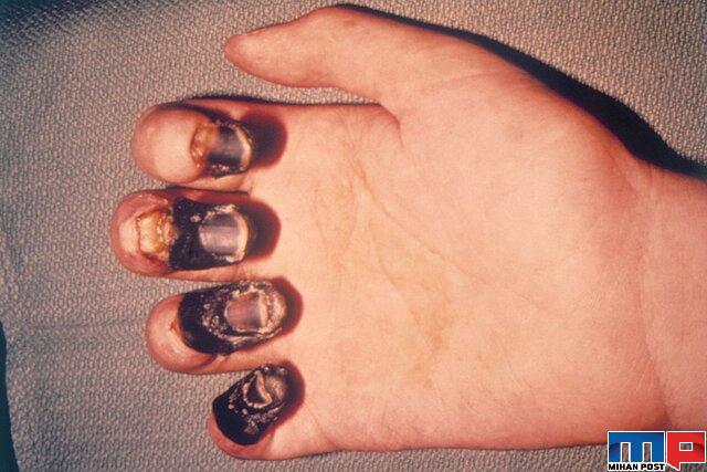 طاعون خیارکی چیست و چگونه منتقل خواهد شد ؟ 7 طاعون خیارکی چیست