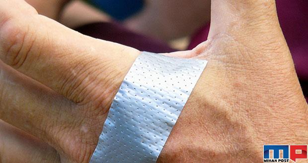 کندن زگیل های کوچک با استفاده از یک روش خانگی 10 کندن زگیل های کوچک